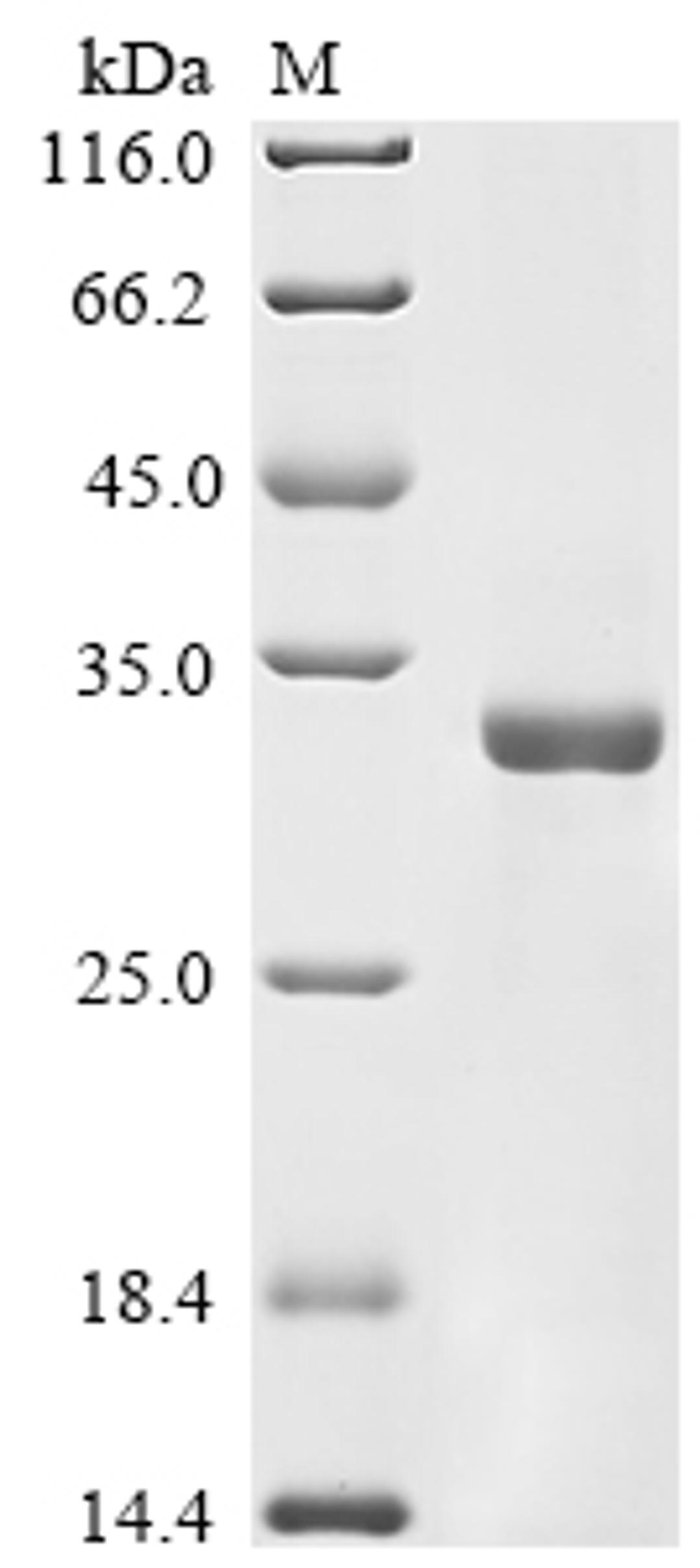 (Tris-Glycine gel) Discontinuous SDS-PAGE (reduced) with 5% enrichment gel and 15% separation gel.