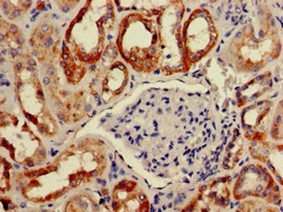 Immunohistochemistry of paraffin-embedded human kidney tissue using CSB-PA891988LA01HU at dilution of 1:100