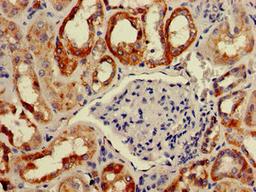 Immunohistochemistry of paraffin-embedded human kidney tissue using CSB-PA891988LA01HU at dilution of 1:100