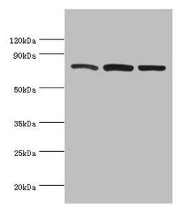 Western blot. All lanes: Calpain-1 catalytic subunit antibody at 2ug/ml. Lane 1: A431 whole cell lysate. Lane 2: Hela whole cell lysate. Lane 3: Jurkat whole cell lysate. Secondary. Goat polyclonal to rabbit IgG at 1/10000 dilution. Predicted band size: 82 kDa. Observed band size: 82 kDa. 