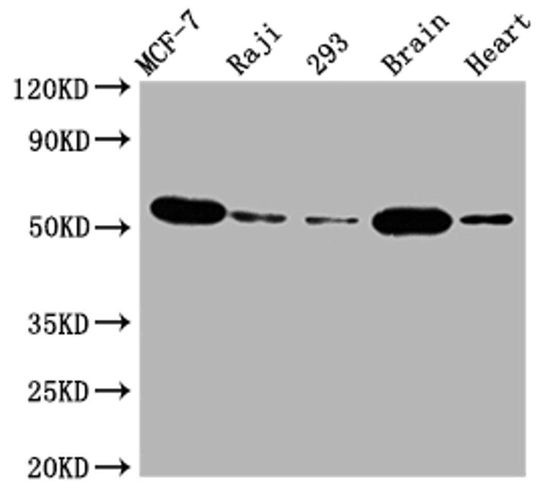 Western Blot. Positive WB detected in: MCF-7 whole cell lysate, Raji whole cell lysate, 293 whole cell lysate, Mouse brain tissue, Rat heart tissue. All lanes: AKT1 antibody at 1:2000. Secondary. Goat polyclonal to rabbit IgG at 1/50000 dilution. Predicted band size: 56 kDa. Observed band size: 56 kDa.