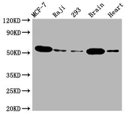Western Blot. Positive WB detected in: MCF-7 whole cell lysate, Raji whole cell lysate, 293 whole cell lysate, Mouse brain tissue, Rat heart tissue. All lanes: AKT1 antibody at 1:2000. Secondary. Goat polyclonal to rabbit IgG at 1/50000 dilution. Predicted band size: 56 kDa. Observed band size: 56 kDa.