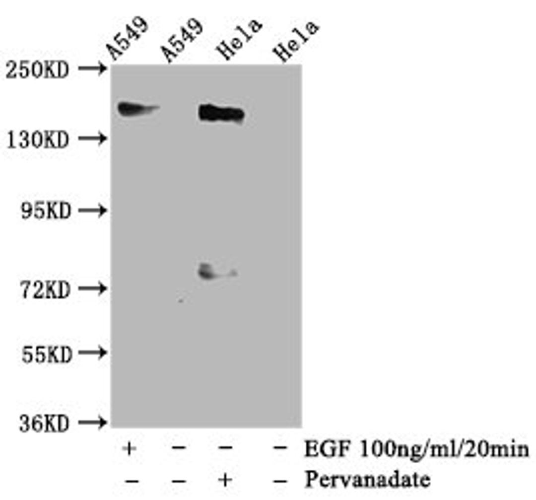 Western Blot. Positive WB detected in A549 whole cell lysate,Hela whole cell lysate(treated with Pervanadate or EGF). All lanes Phospho-EGFR antibody at 1.35μg/ml. Secondary. Goat polyclonal to rabbit IgG at 1/50000 dilution. Predicted band size: 170 KDa. Observed band size: 170 KDa. 