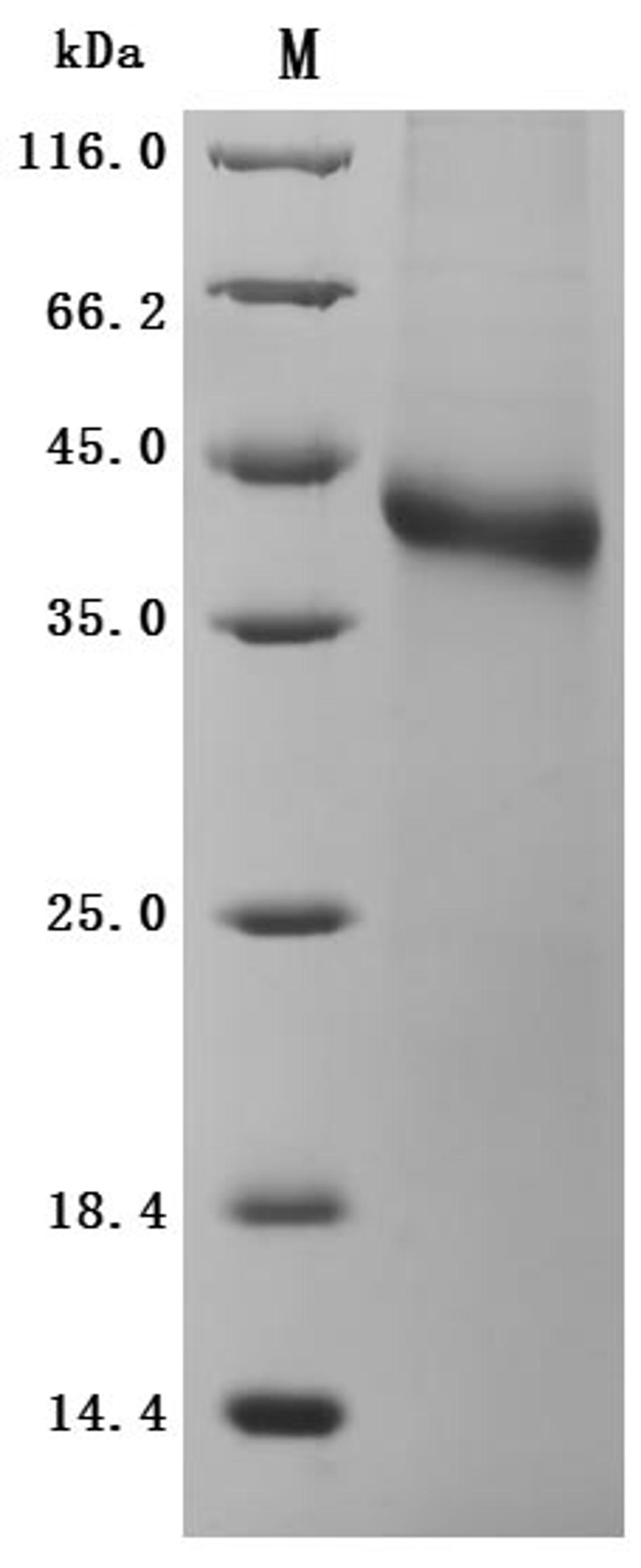 (Tris-Glycine gel) Discontinuous SDS-PAGE (reduced) with 5% enrichment gel and 15% separation gel.