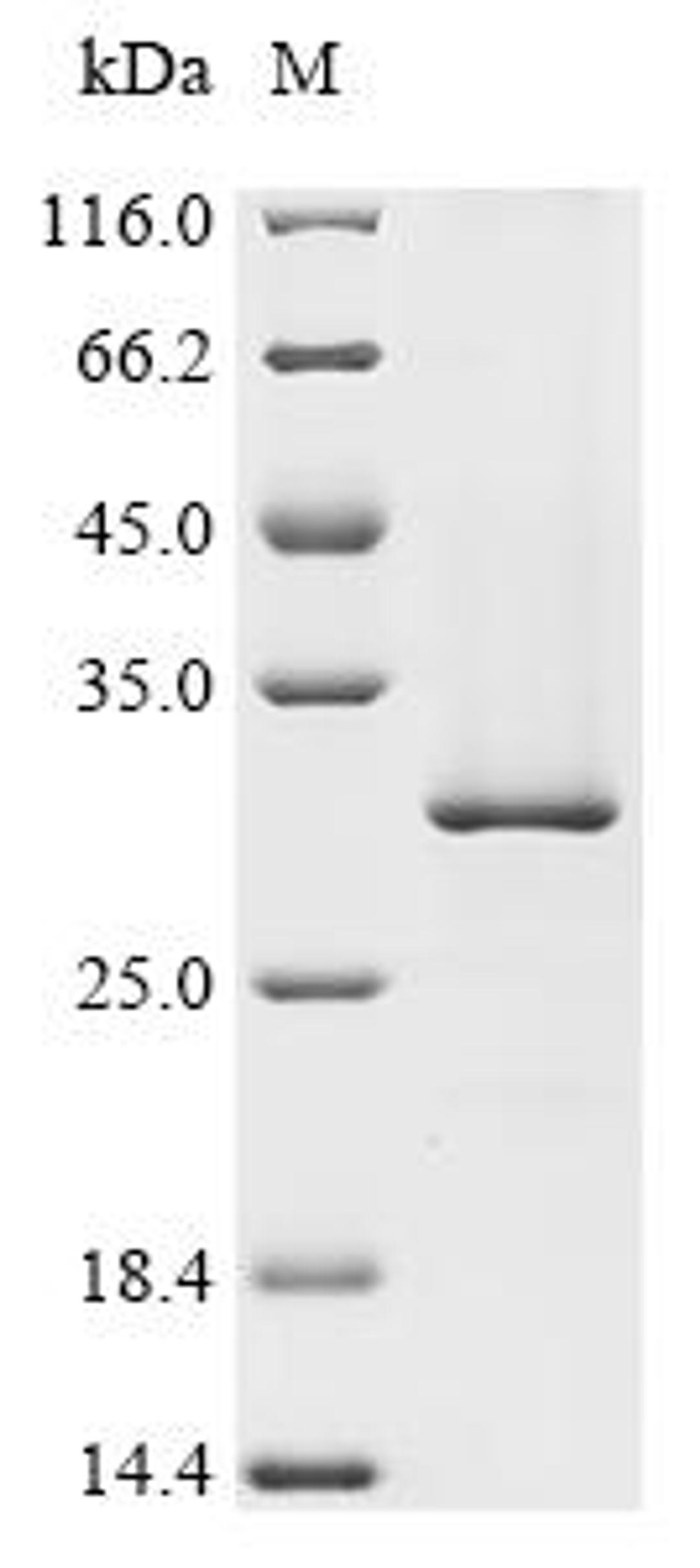 (Tris-Glycine gel) Discontinuous SDS-PAGE (reduced) with 5% enrichment gel and 15% separation gel.