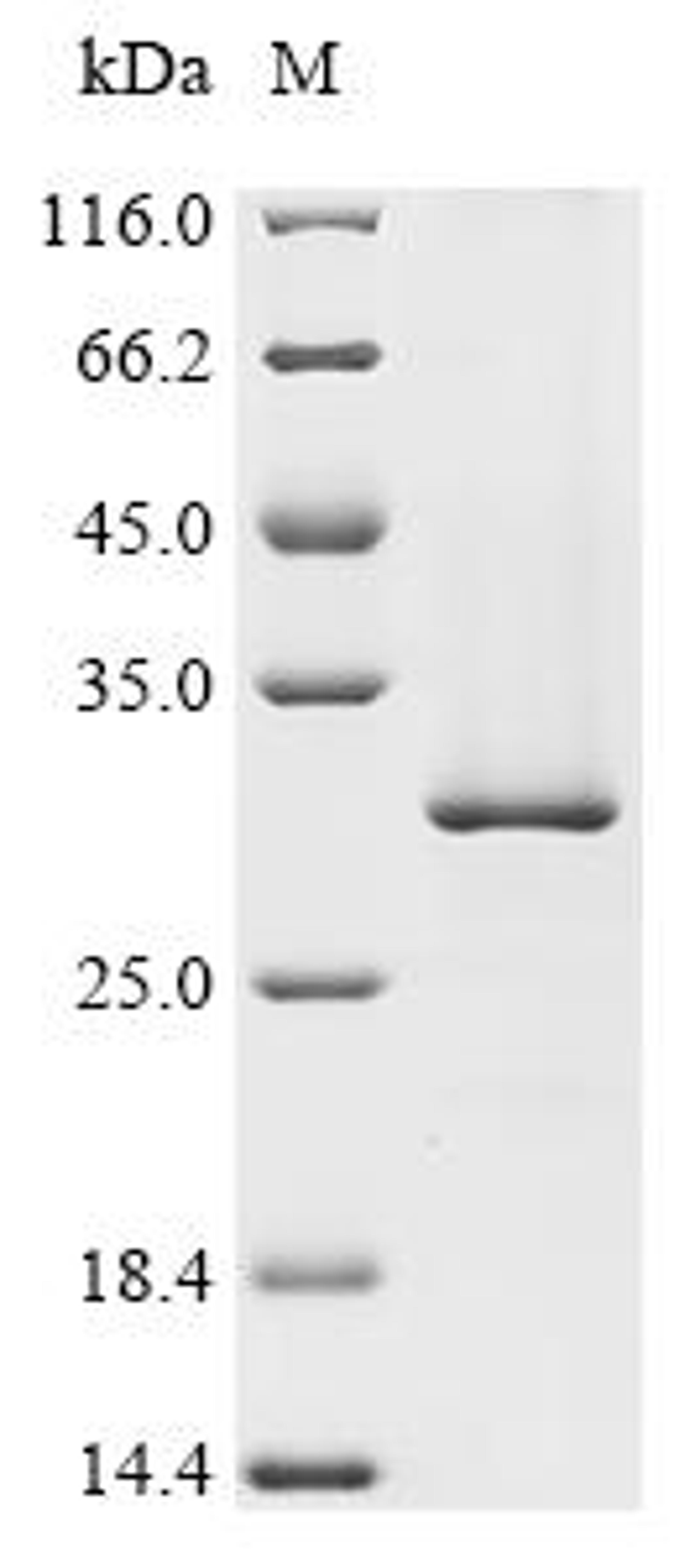 (Tris-Glycine gel) Discontinuous SDS-PAGE (reduced) with 5% enrichment gel and 15% separation gel.