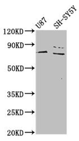 Western Blot. Positive WB detected in: U87 whole cell lysate, SH-SY5Y whole cell lysate. All lanes: TIPARP antibody at 4.6µg/ml. Secondary. Goat polyclonal to rabbit IgG at 1/50000 dilution. Predicted band size: 77 kDa. Observed band size: 77 kDa