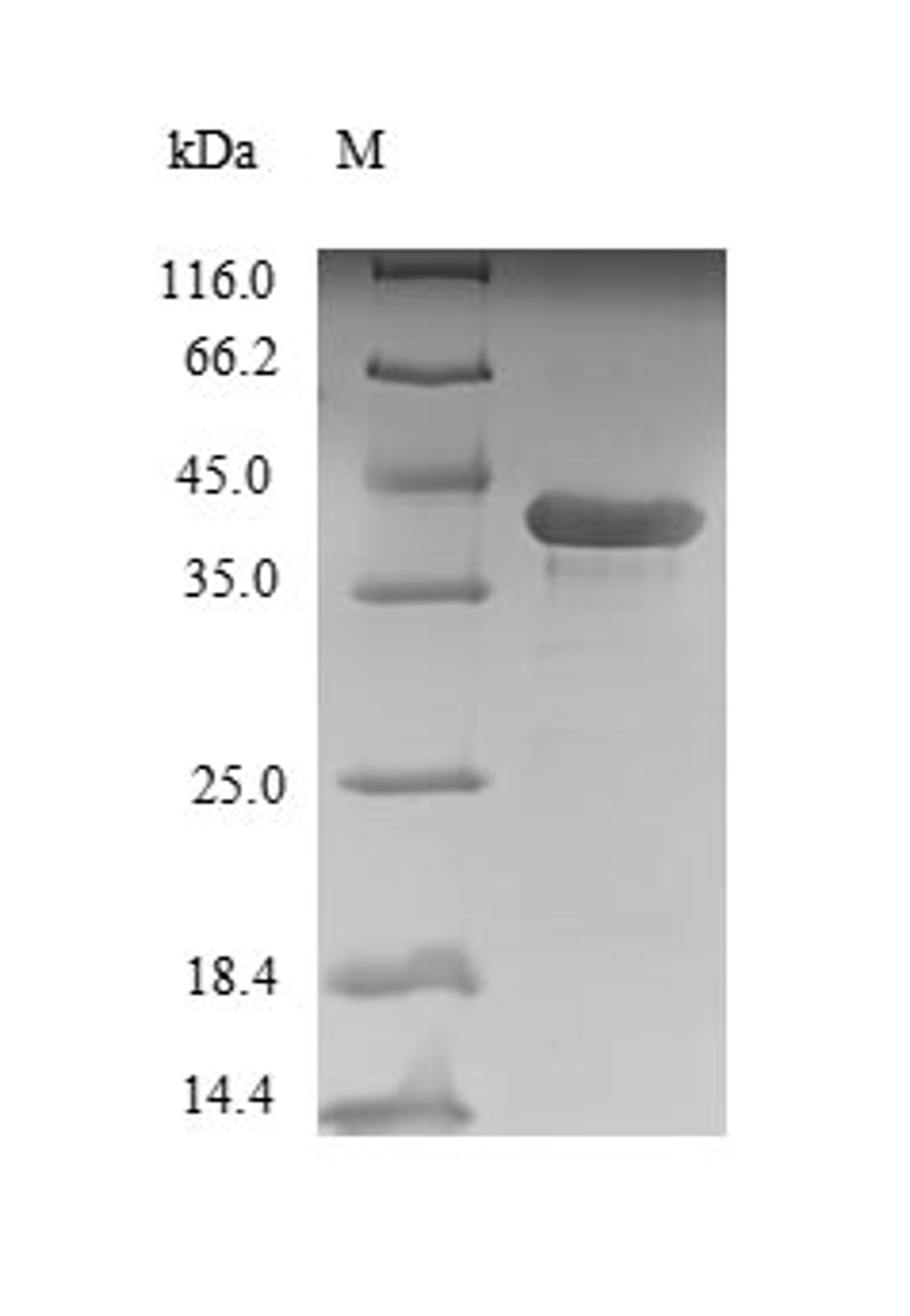 (Tris-Glycine gel) Discontinuous SDS-PAGE (reduced) with 5% enrichment gel and 15% separation gel.