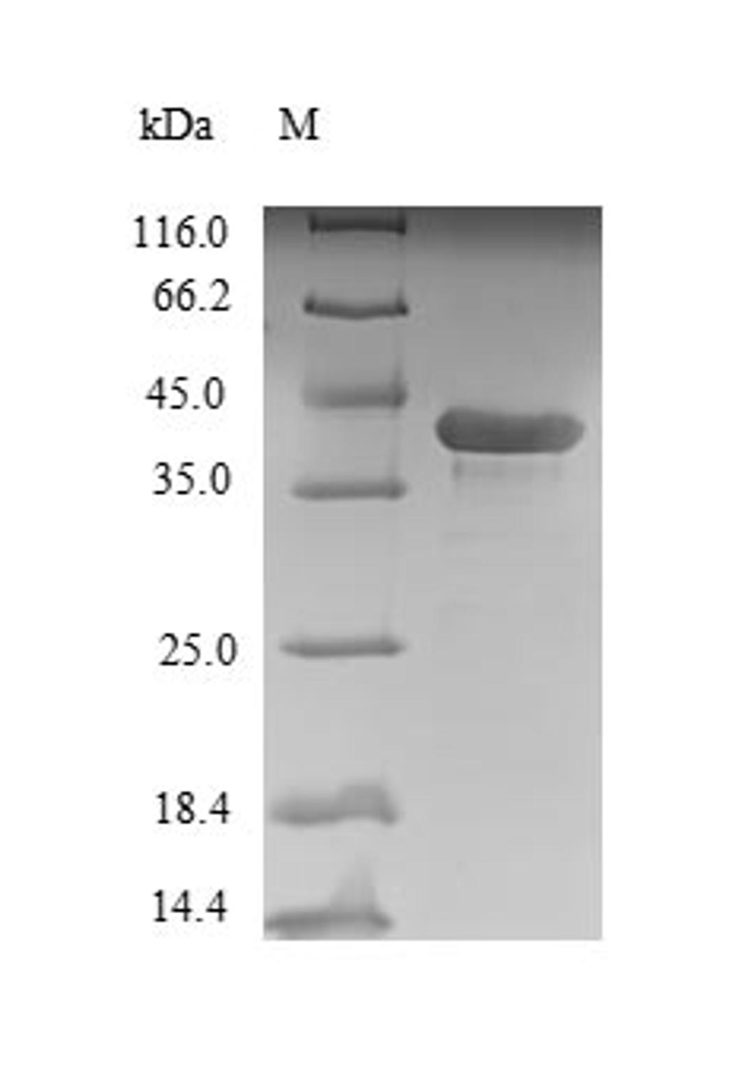 (Tris-Glycine gel) Discontinuous SDS-PAGE (reduced) with 5% enrichment gel and 15% separation gel.