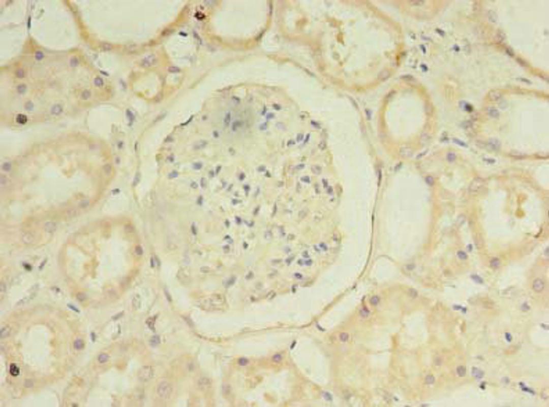 Immunohistochemistry of paraffin-embedded human kidney tissue using CSB-PA713104LA01HU at dilution of 1:100