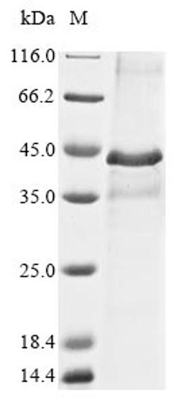 (Tris-Glycine gel) Discontinuous SDS-PAGE (reduced) with 5% enrichment gel and 15% separation gel.