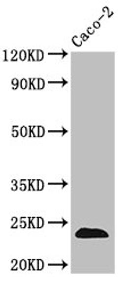 Western Blot. Positive WB detected in: Caco-2 whole cell lysate. All lanes: CLDN3 antibody at 3.5µg/ml. Secondary. Goat polyclonal to rabbit IgG at 1/50000 dilution. Predicted band size: 24 kDa. Observed band size: 24 kDa