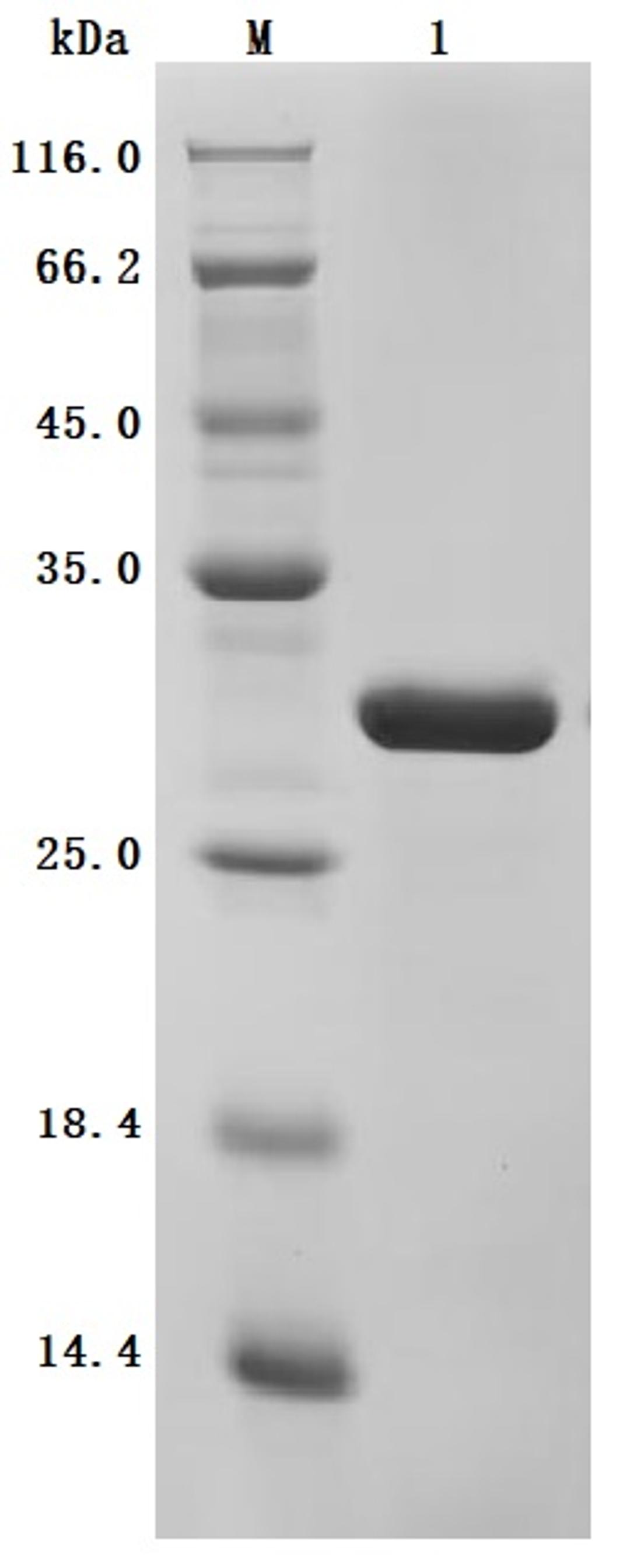 (Tris-Glycine gel) Discontinuous SDS-PAGE (reduced) with 5% enrichment gel and 15% separation gel.