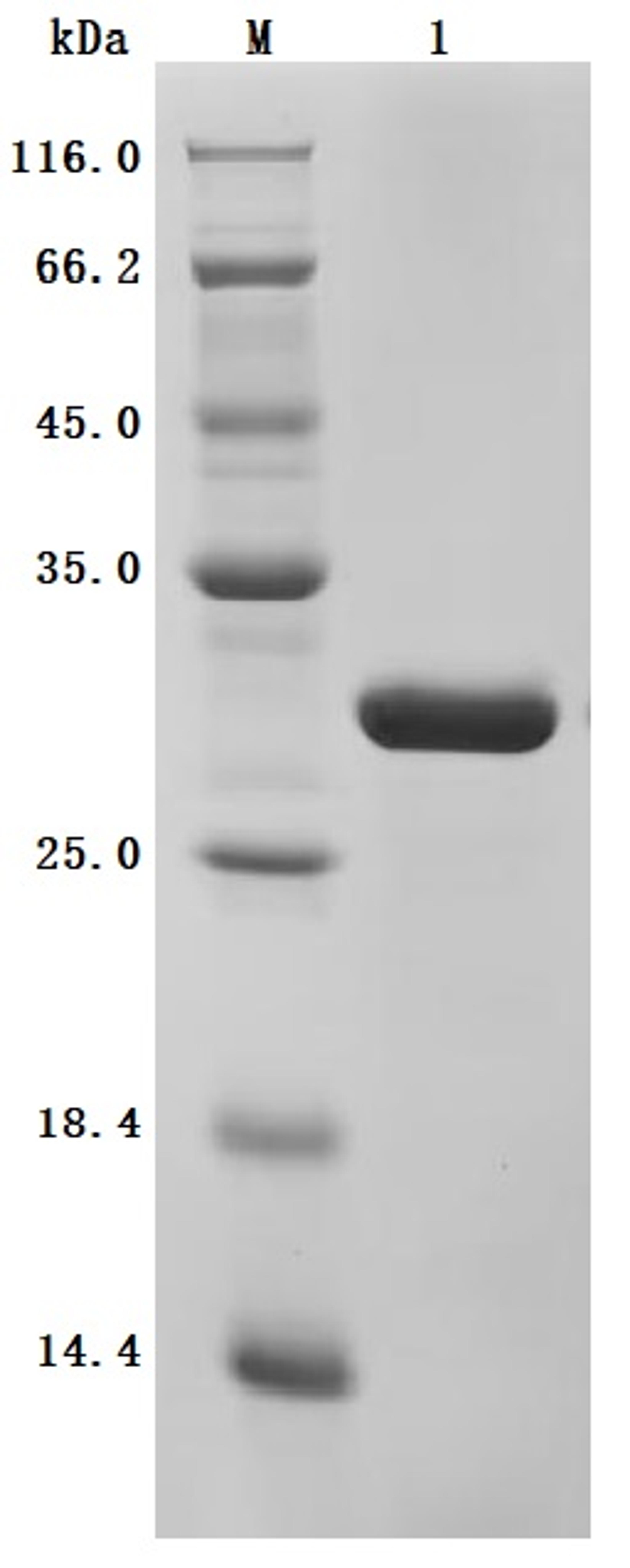(Tris-Glycine gel) Discontinuous SDS-PAGE (reduced) with 5% enrichment gel and 15% separation gel.