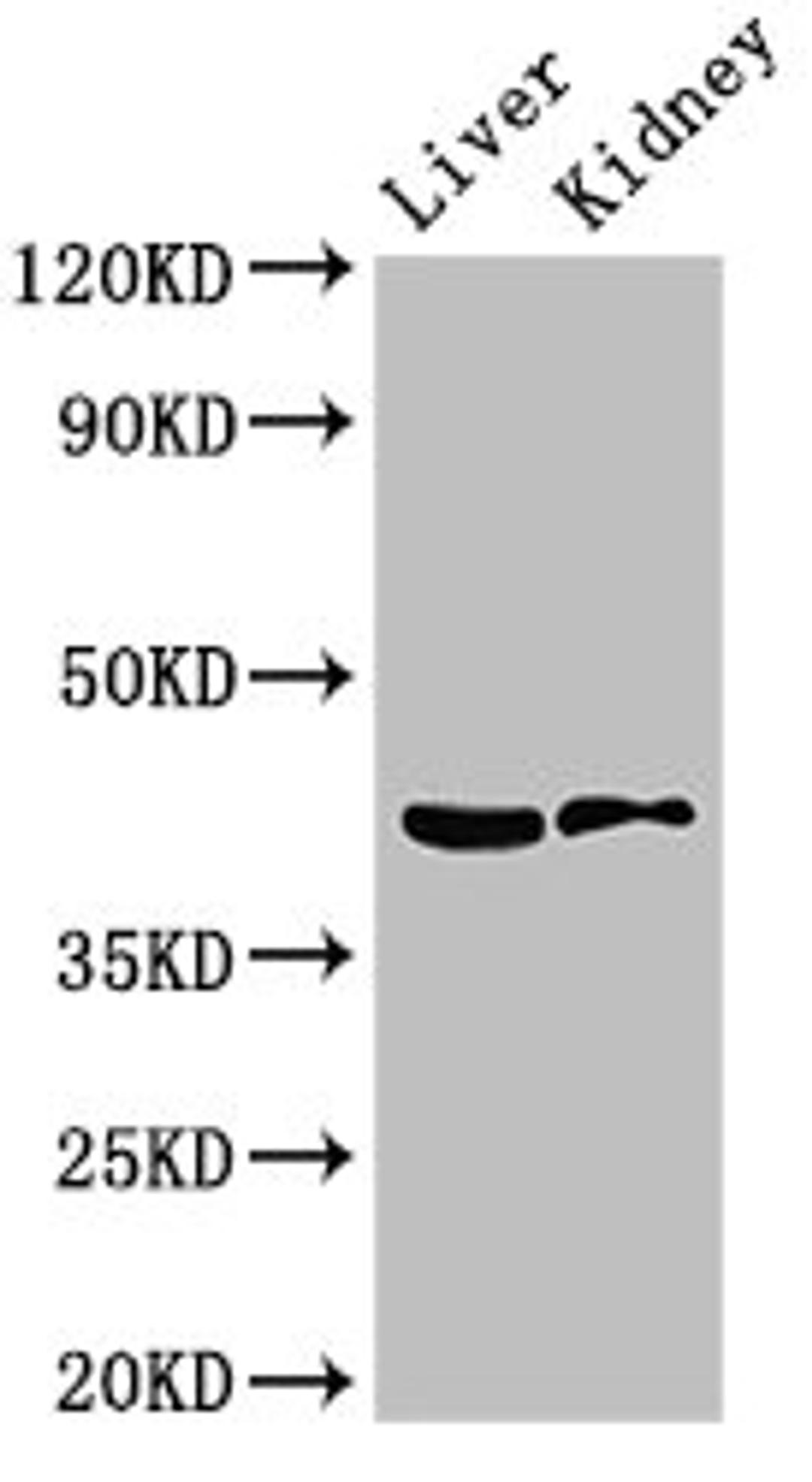 Western Blot. Positive WB detected in: Mouse liver tissue, Mouse kidney tissue. All lanes: HSD3B7 antibody at 3.5ug/ml. Secondary. Goat polyclonal to rabbit IgG at 1/50000 dilution. Predicted band size: 42, 22 kDa. Observed band size: 42 kDa. 
