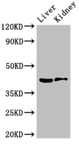 Western Blot. Positive WB detected in: Mouse liver tissue, Mouse kidney tissue. All lanes: HSD3B7 antibody at 3.5ug/ml. Secondary. Goat polyclonal to rabbit IgG at 1/50000 dilution. Predicted band size: 42, 22 kDa. Observed band size: 42 kDa. 
