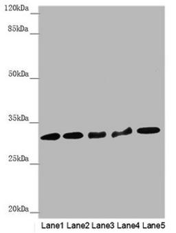 Western blot. All lanes: HCCS antibody at 2.05µg/ml. Lane 1: Mouse heart tissue. Lane 2: Hela whole cell lysate. Lane 3: RAW264.7 whole cell lysate. Lane 4: MCF-7 whole cell lysate. Lane 5: HepG2 whole cell lysate. Secondary. Goat polyclonal to rabbit IgG at 1/10000 dilution. Predicted band size: 31 kDa. Observed band size: 31 kDa