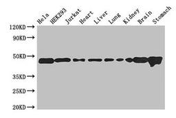Western Blot. Positive WB detected in: Hela whole cell lysate, HEK293 whole cell lysate, Jurkat whole cell lysate, Mouse heart tissue, Mouse liver tissue, Mouse lung tissue, Mouse kidney tissue, Mouse brain tissue, Mouse stomach tissue. All lanes: ASCC1 antibody at 2.7µg/ml. Secondary. Goat polyclonal to rabbit IgG at 1/50000 dilution. Predicted band size: 46, 42 kDa. Observed band size: 46 kDa
