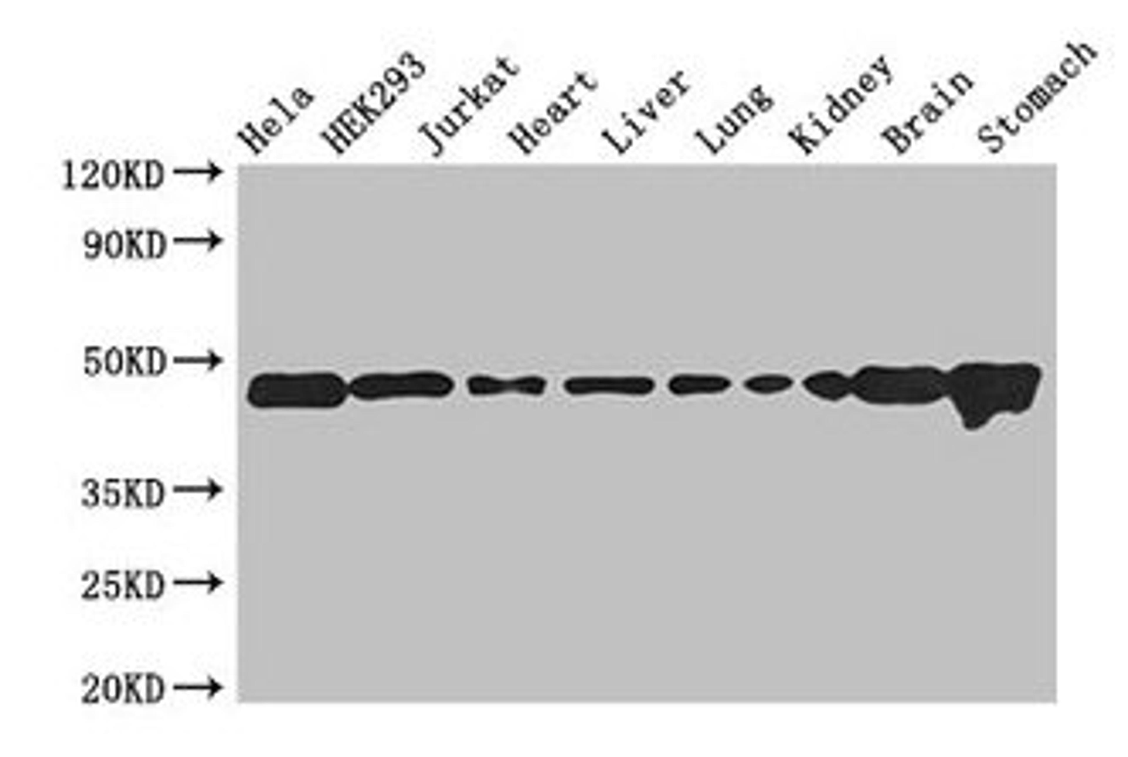 Western Blot. Positive WB detected in: Hela whole cell lysate, HEK293 whole cell lysate, Jurkat whole cell lysate, Mouse heart tissue, Mouse liver tissue, Mouse lung tissue, Mouse kidney tissue, Mouse brain tissue, Mouse stomach tissue. All lanes: ASCC1 antibody at 2.7µg/ml. Secondary. Goat polyclonal to rabbit IgG at 1/50000 dilution. Predicted band size: 46, 42 kDa. Observed band size: 46 kDa