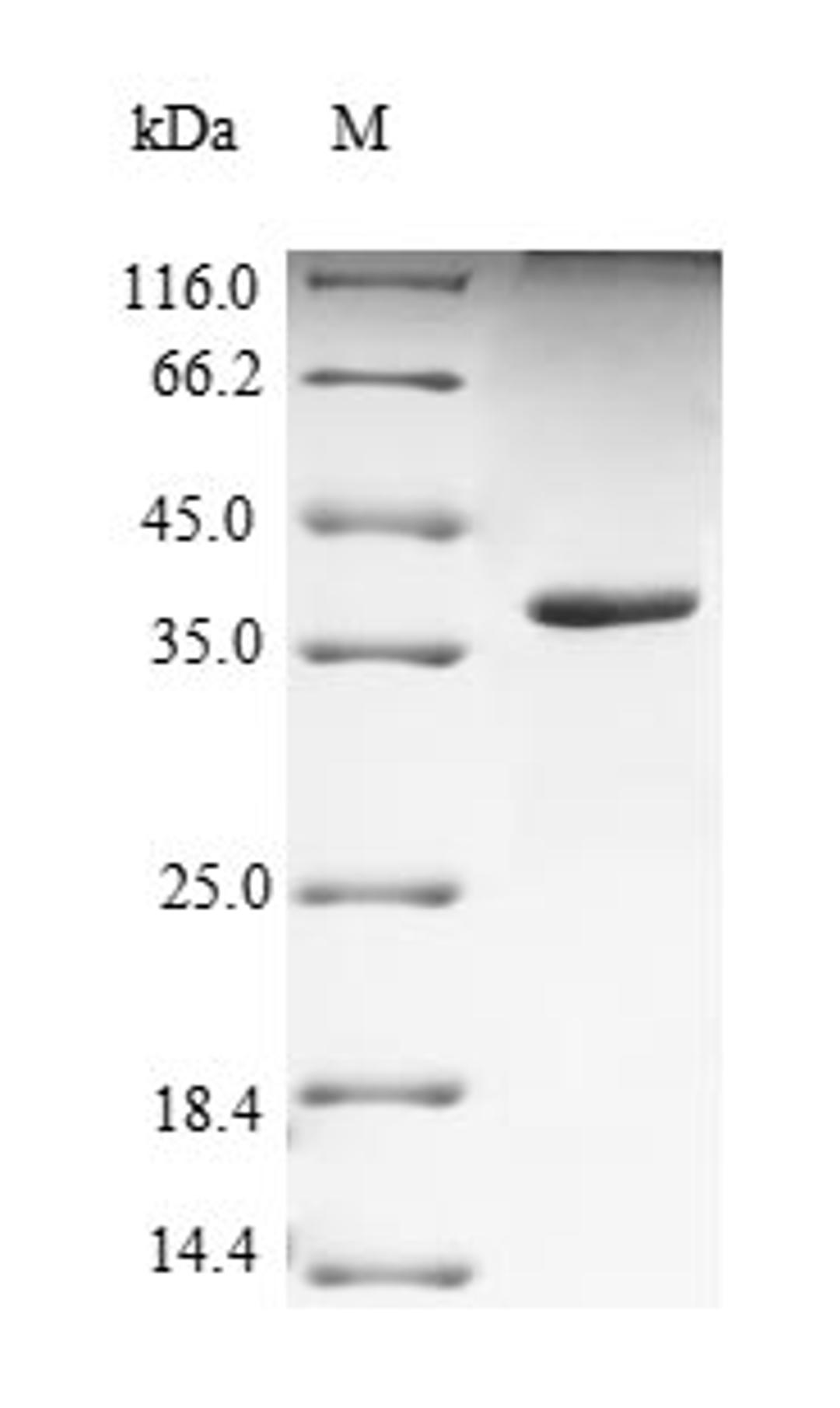 (Tris-Glycine gel) Discontinuous SDS-PAGE (reduced) with 5% enrichment gel and 15% separation gel.