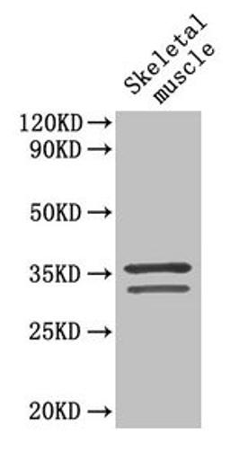 Western Blot. Positive WB detected in: Mouse skeletal muscle tissue. All lanes: TNNT2 antibody at 4µg/ml. Secondary. Goat polyclonal to rabbit IgG at 1/50000 dilution. Predicted band size: 36, 35, 32, 31 kDa. Observed band size: 36, 32 kDa
