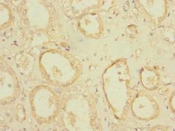 Immunohistochemistry of paraffin-embedded human kidney tissue using CSB-PA018298LA01HU at dilution of 1:100