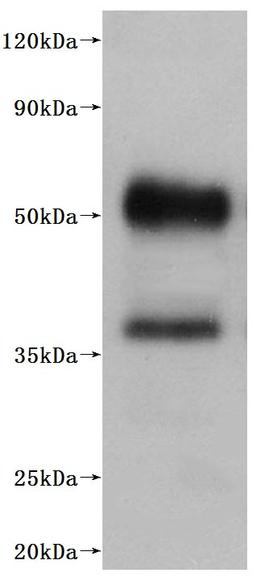 CSB-MP003996HU is detected by Mouse anti-6*His monoclonal antibody.