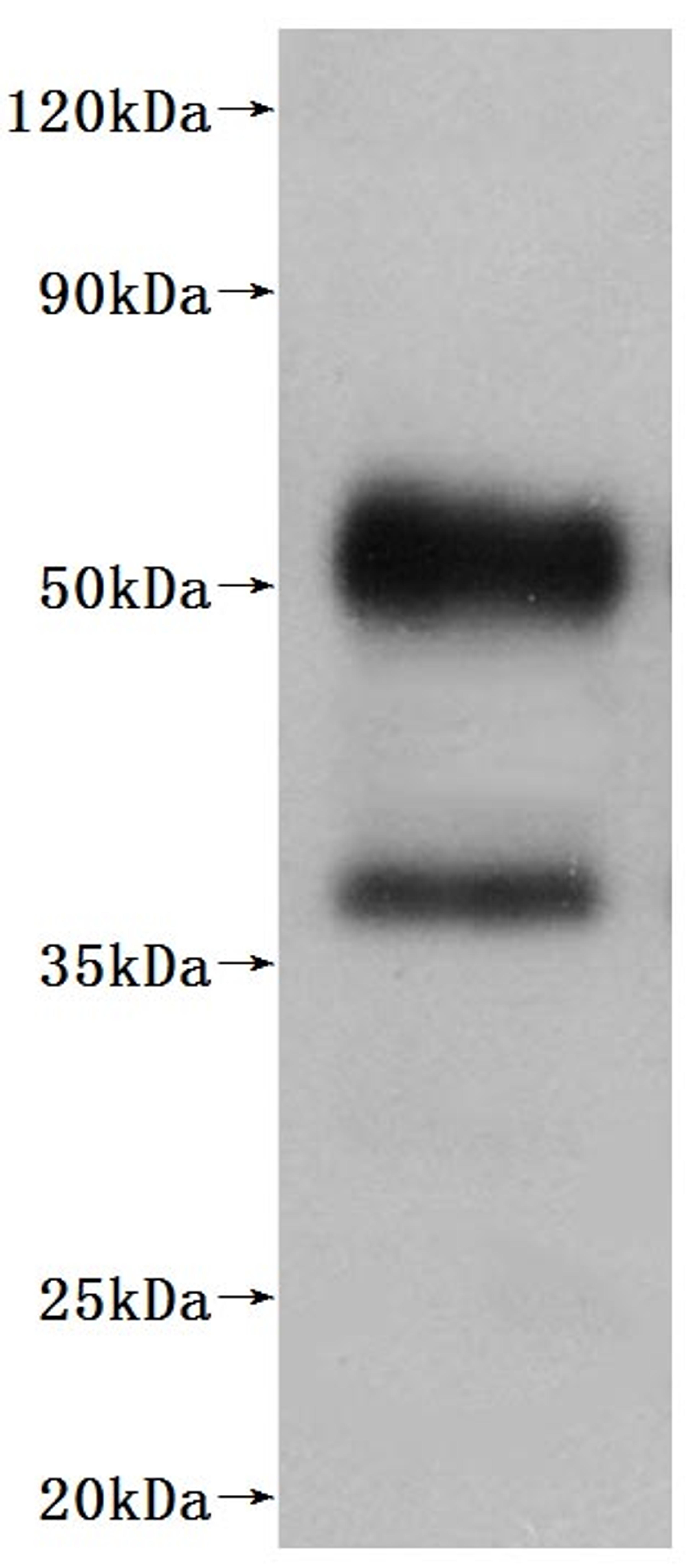 CSB-MP003996HU is detected by Mouse anti-6*His monoclonal antibody.
