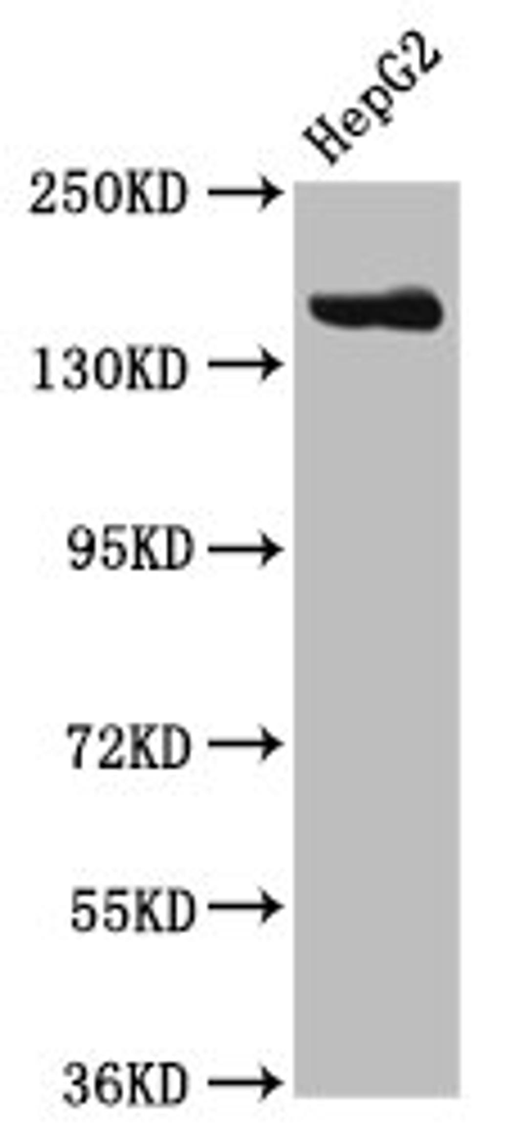 Western Blot. Positive WB detected in: HepG2 whole cell lysate. All lanes: CPS1 antibody at 3.8µg/ml. Secondary. Goat polyclonal to rabbit IgG at 1/50000 dilution. Predicted band size: 165, 117, 166 kDa. Observed band size: 165 kDa