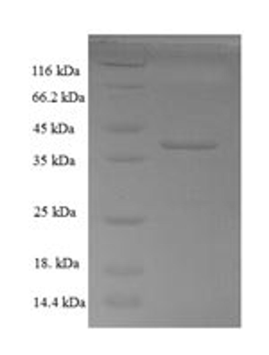 (Tris-Glycine gel) Discontinuous SDS-PAGE (reduced) with 5% enrichment gel and 15% separation gel.