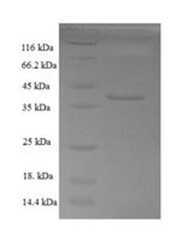 (Tris-Glycine gel) Discontinuous SDS-PAGE (reduced) with 5% enrichment gel and 15% separation gel.