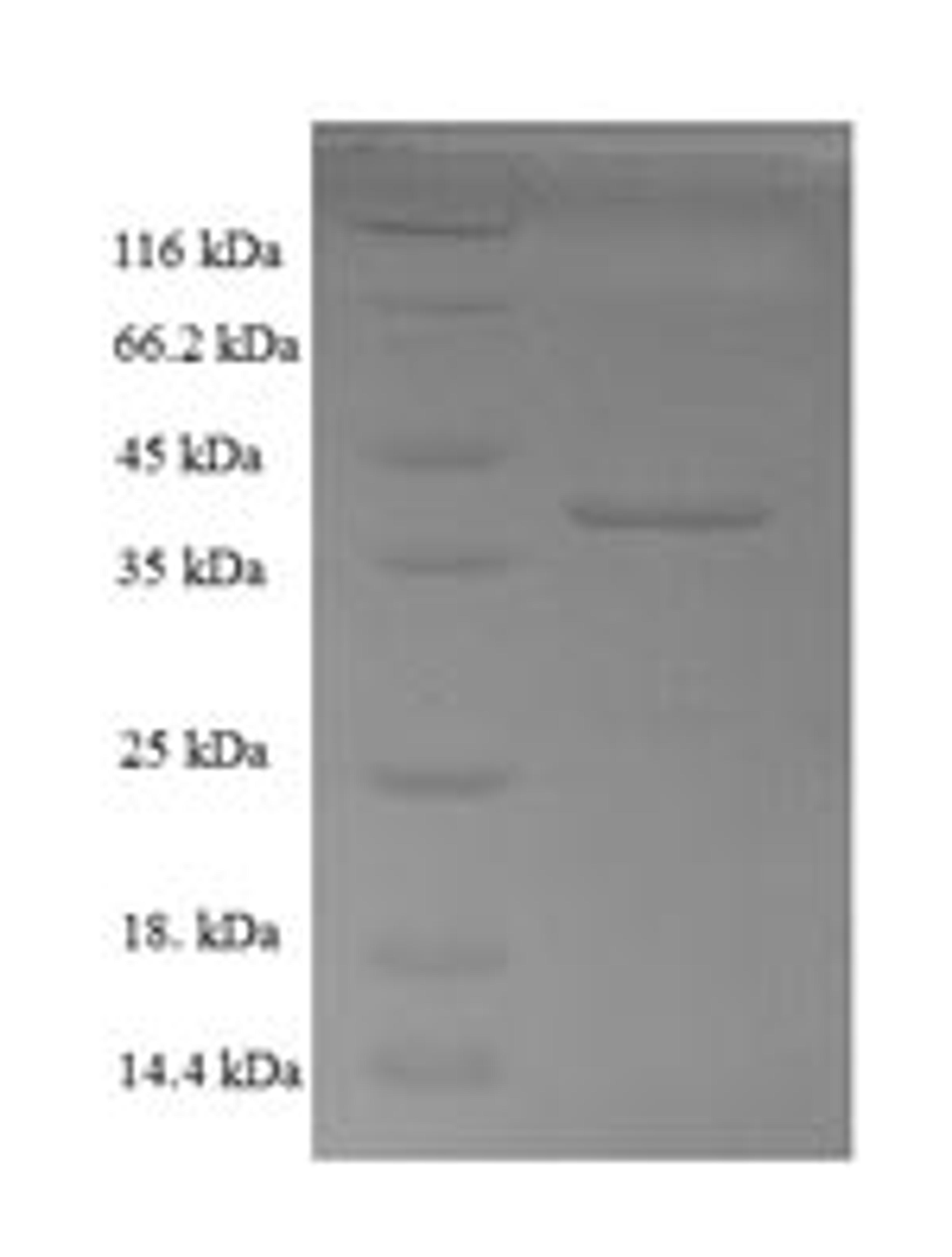 (Tris-Glycine gel) Discontinuous SDS-PAGE (reduced) with 5% enrichment gel and 15% separation gel.