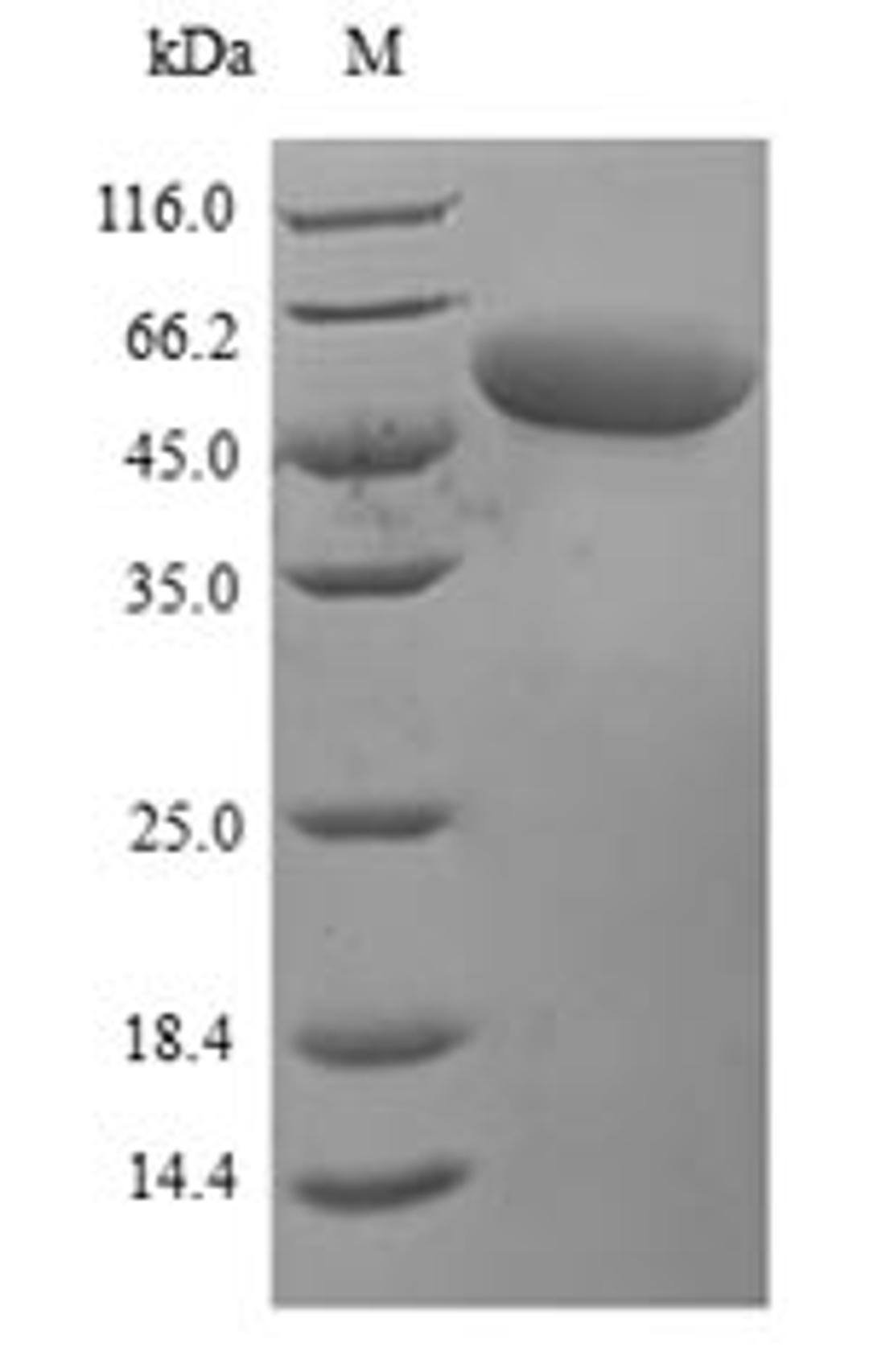 (Tris-Glycine gel) Discontinuous SDS-PAGE (reduced) with 5% enrichment gel and 15% separation gel.