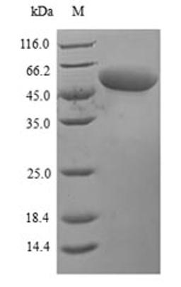 (Tris-Glycine gel) Discontinuous SDS-PAGE (reduced) with 5% enrichment gel and 15% separation gel.