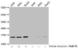 Western Blot. Detected samples: A549 whole cell lysate, K562 whole cell lysate, HepG2 whole cell lysate; Untreated (-) or treated (+) with 30mM sodium butyrate for 4h. All lanes: HIST1H2BC antibody at 1:100. Secondary. Goat polyclonal to rabbit IgG at 1/50000 dilution. Predicted band size: 14 kDa. Observed band size: 14 kDa