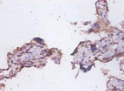 Immunohistochemistry of paraffin-embedded human placenta tissue using CSB-PA06354A0Rb at dilution of 1:100