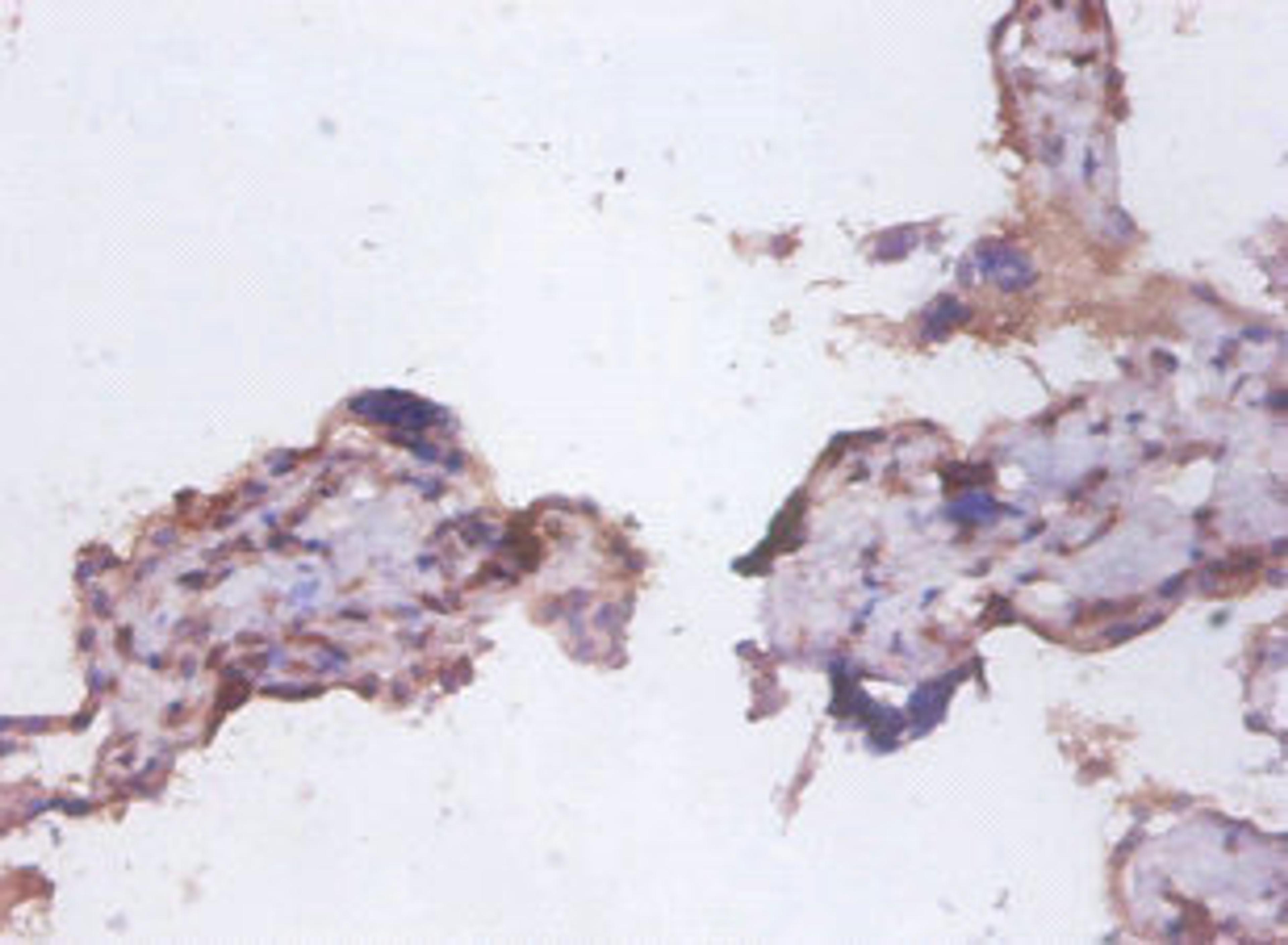 Immunohistochemistry of paraffin-embedded human placenta tissue using CSB-PA06354A0Rb at dilution of 1:100