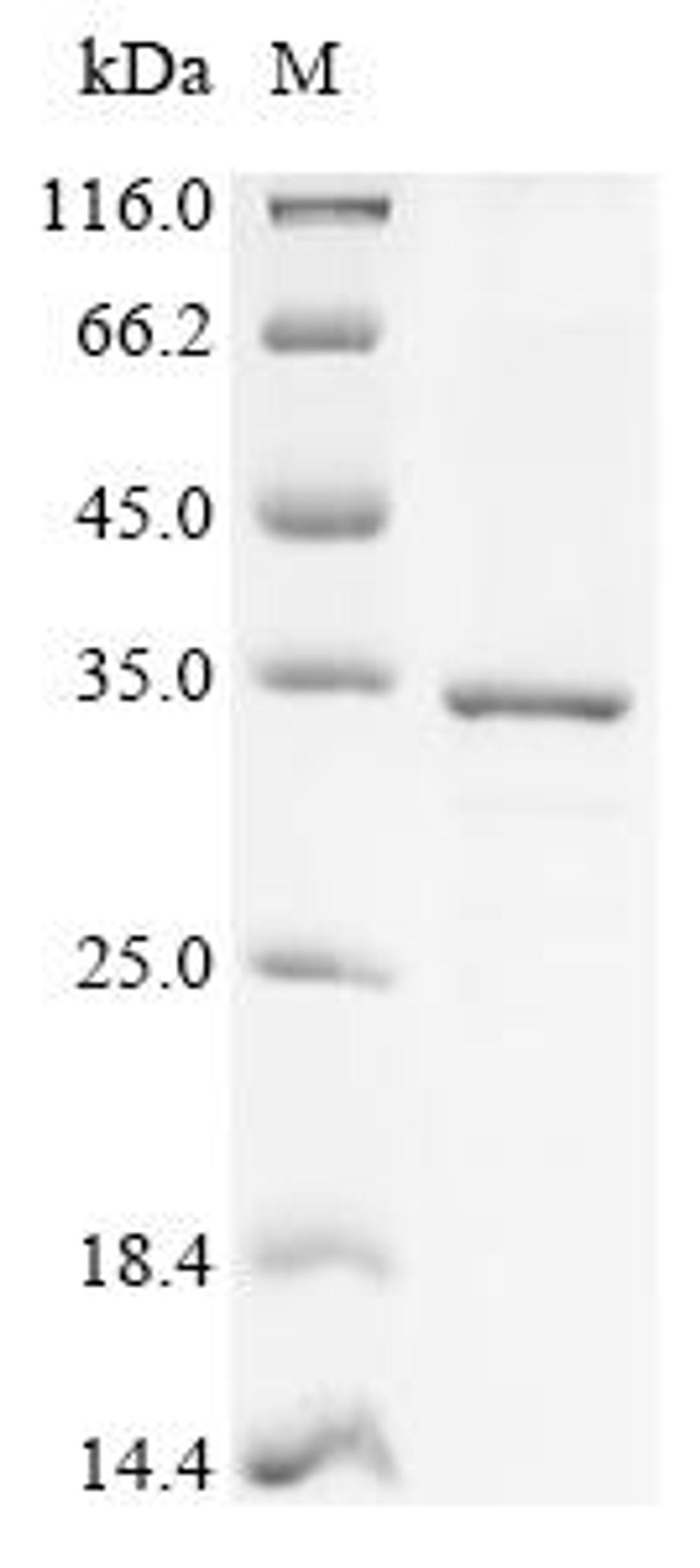(Tris-Glycine gel) Discontinuous SDS-PAGE (reduced) with 5% enrichment gel and 15% separation gel.