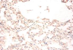 Immunohistochemistry of paraffin-embedded human lung tissue using CSB-PA13354A0Rb at dilution of 1:50