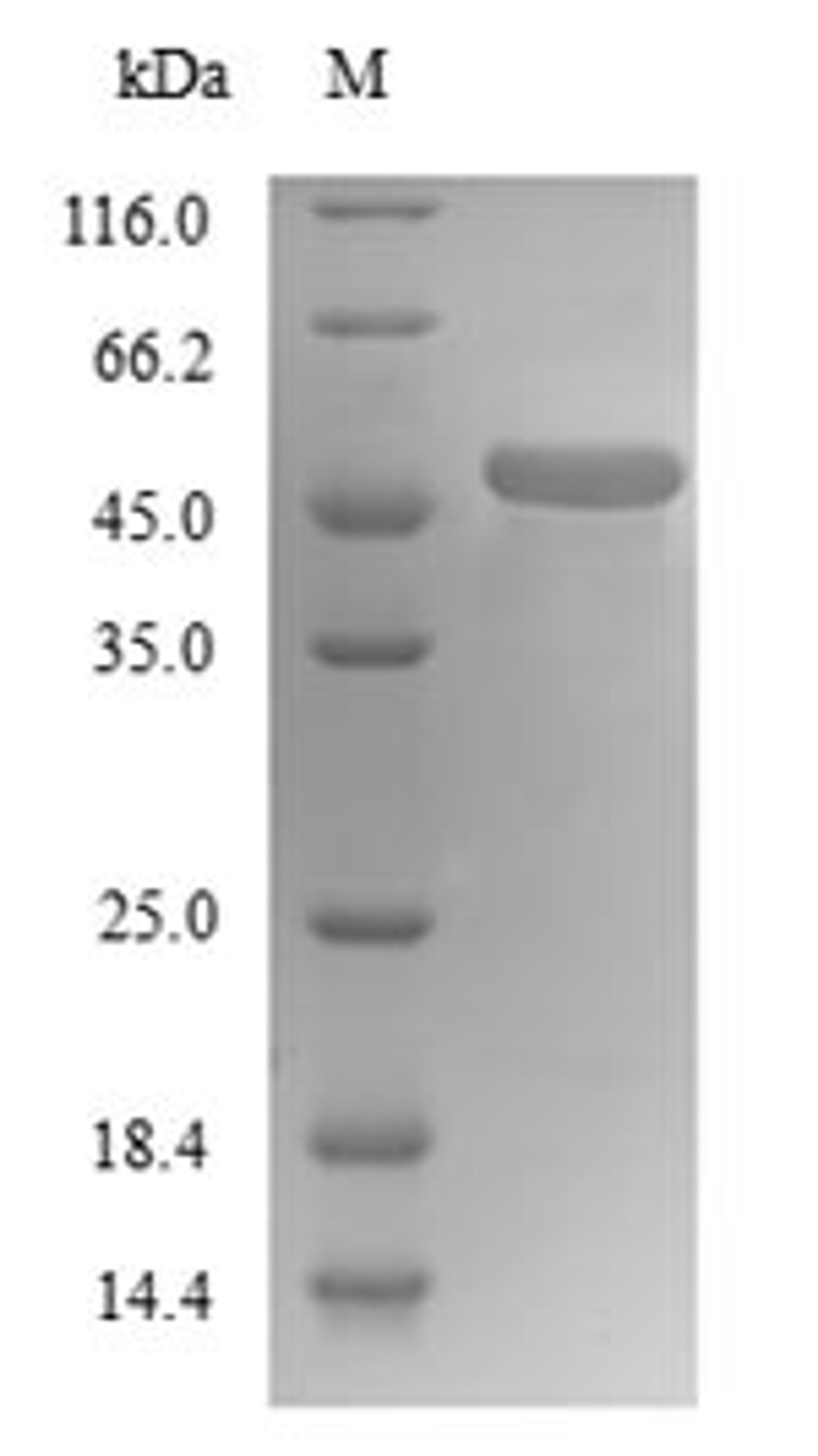 (Tris-Glycine gel) Discontinuous SDS-PAGE (reduced) with 5% enrichment gel and 15% separation gel.