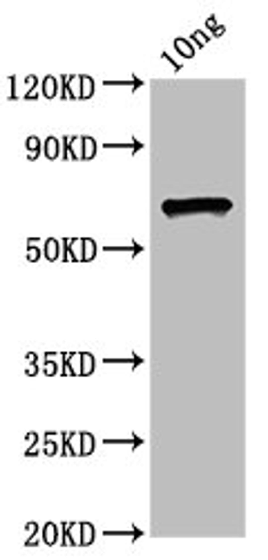 Western Blot. Positive WB detected in Recombinant protein. All lanes: ompC antibody at 4.5µg/ml. Secondary. Goat polyclonal to rabbit IgG at 1/50000 dilution. Predicted band size: 60 kDa. Observed band size: 60 kDa