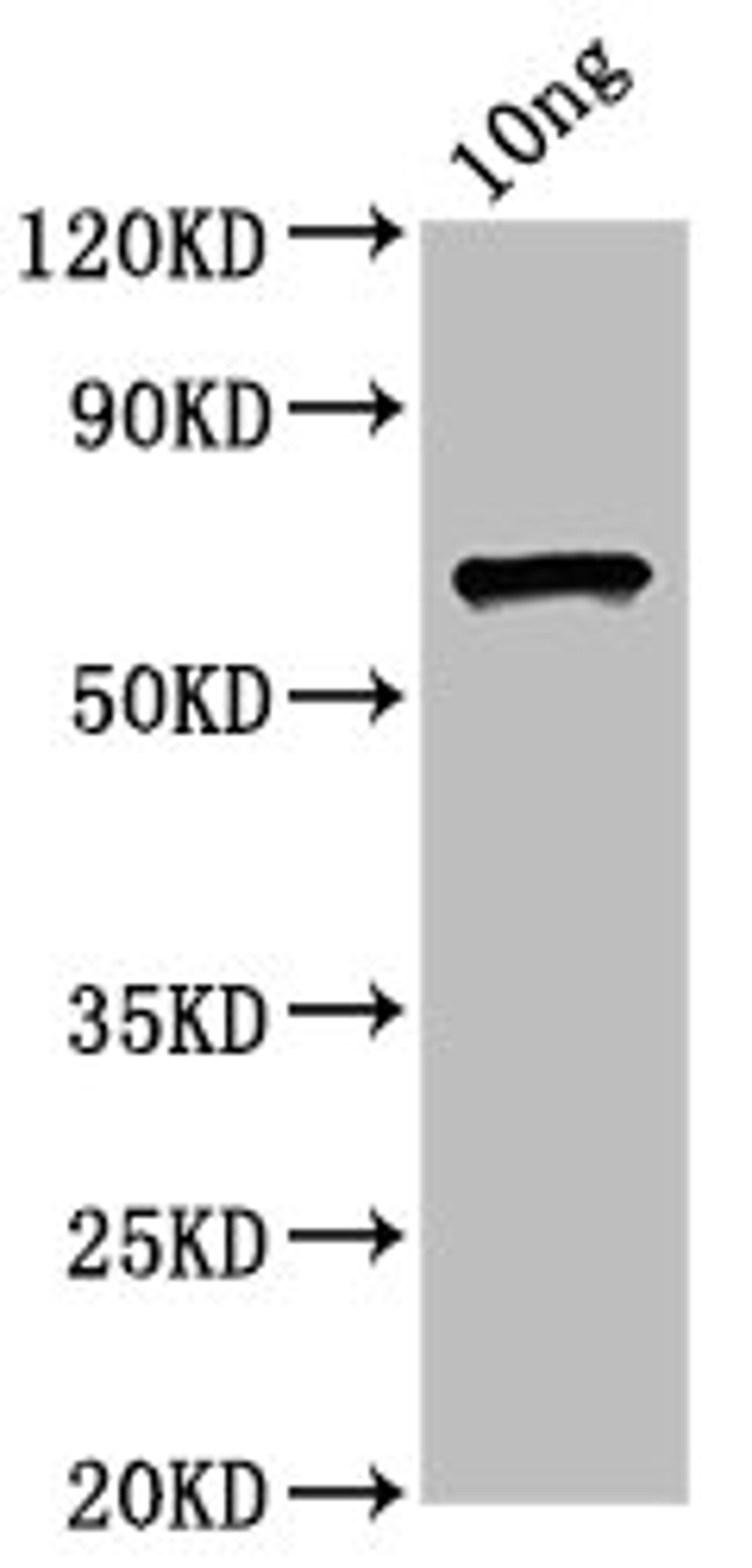 Western Blot. Positive WB detected in Recombinant protein. All lanes: ompC antibody at 4.5µg/ml. Secondary. Goat polyclonal to rabbit IgG at 1/50000 dilution. Predicted band size: 60 kDa. Observed band size: 60 kDa