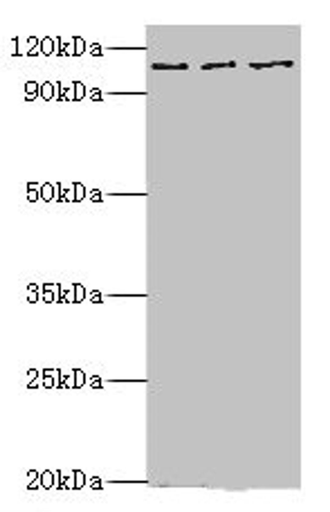 Western blot. All lanes: MERTK antibody at 10ug/ml. Lane 1: Mouse gonad tissue. Lane 2: Mouse lung tissue. Lane 3: Mouse kidney tissue. Secondary. Goat polyclonal to rabbit IgG at 1/10000 dilution. Predicted band size: 110 kDa. Observed band size: 110 kDa. 