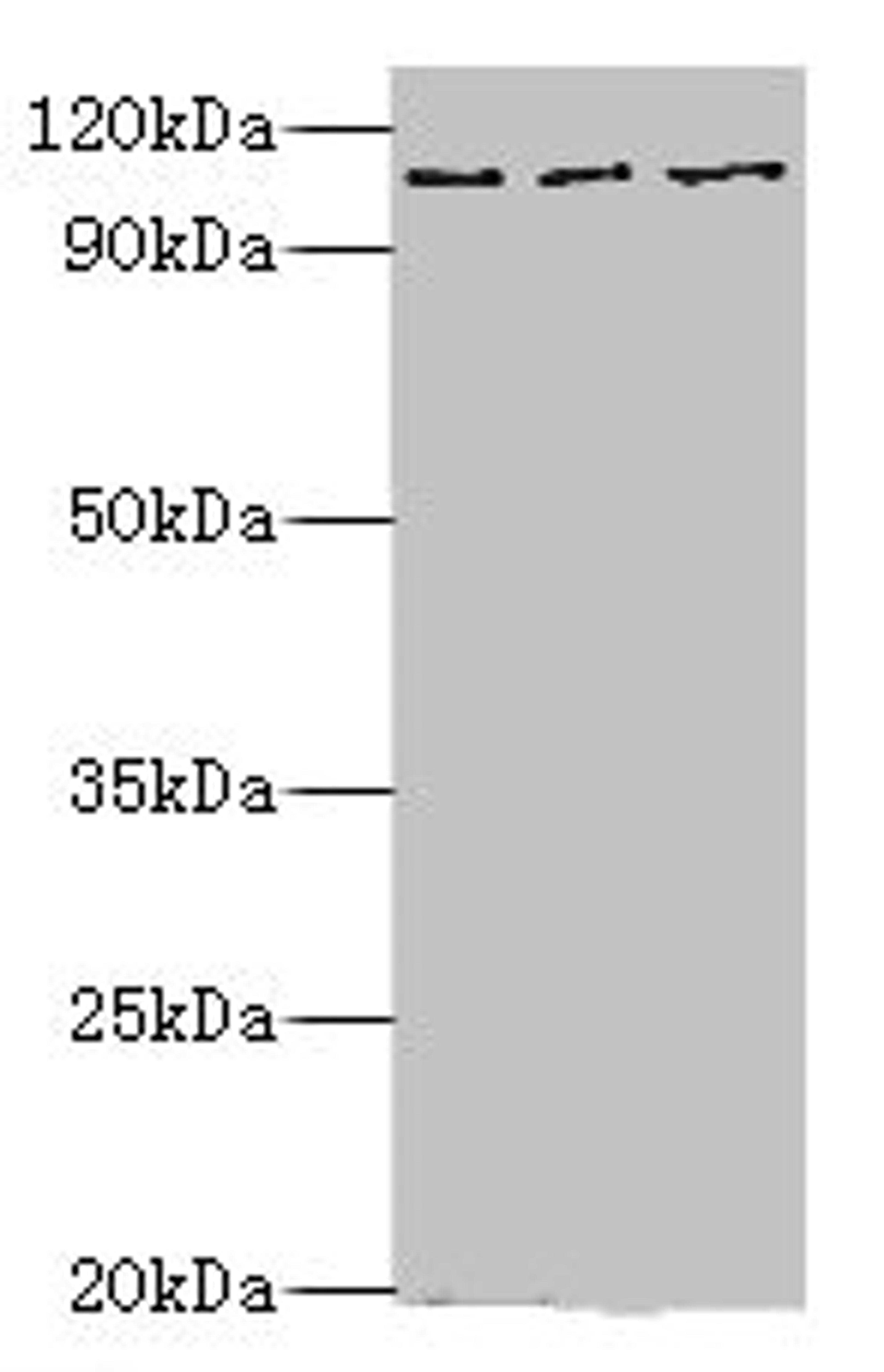 Western blot. All lanes: MERTK antibody at 10ug/ml. Lane 1: Mouse gonad tissue. Lane 2: Mouse lung tissue. Lane 3: Mouse kidney tissue. Secondary. Goat polyclonal to rabbit IgG at 1/10000 dilution. Predicted band size: 110 kDa. Observed band size: 110 kDa. 