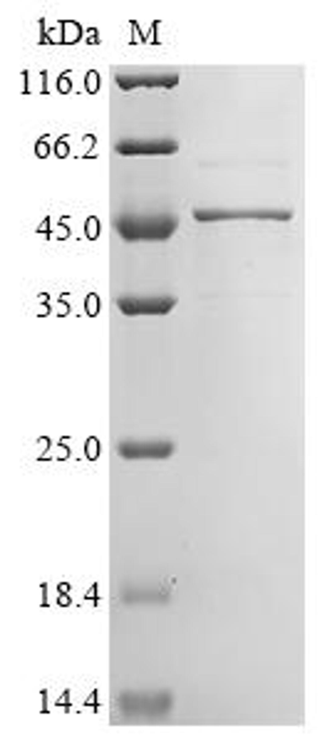 (Tris-Glycine gel) Discontinuous SDS-PAGE (reduced) with 5% enrichment gel and 15% separation gel.