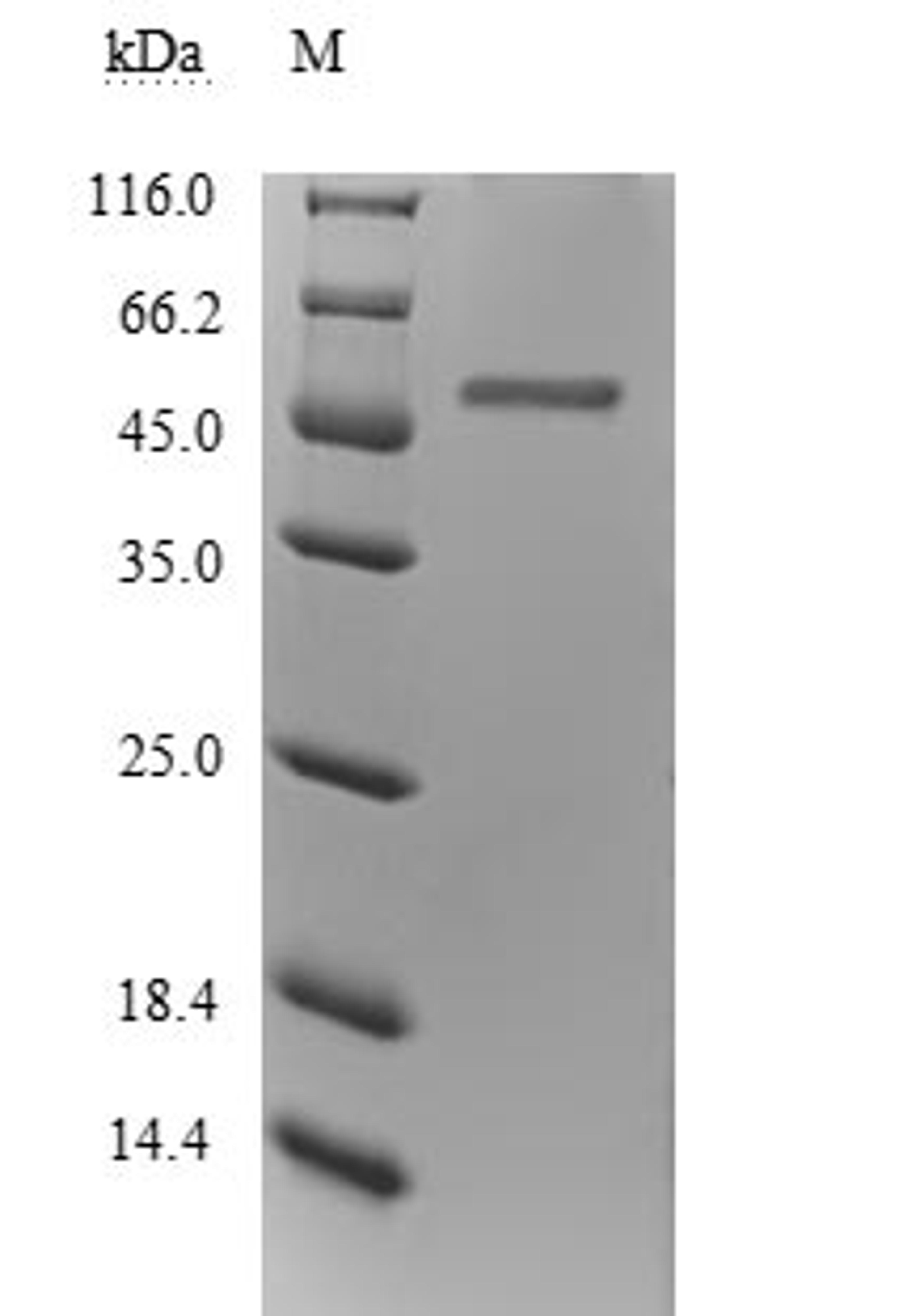 (Tris-Glycine gel) Discontinuous SDS-PAGE (reduced) with 5% enrichment gel and 15% separation gel.