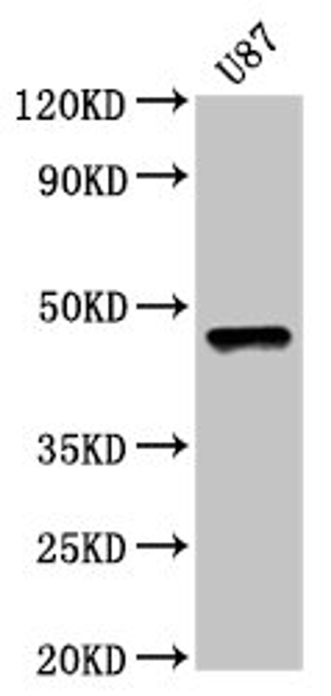 Western Blot. Positive WB detected in: U87 whole cell lysate. All lanes: SOX8 antibody at 5µg/ml. Secondary. Goat polyclonal to rabbit IgG at 1/50000 dilution. Predicted band size: 48 kDa. Observed band size: 48 kDa