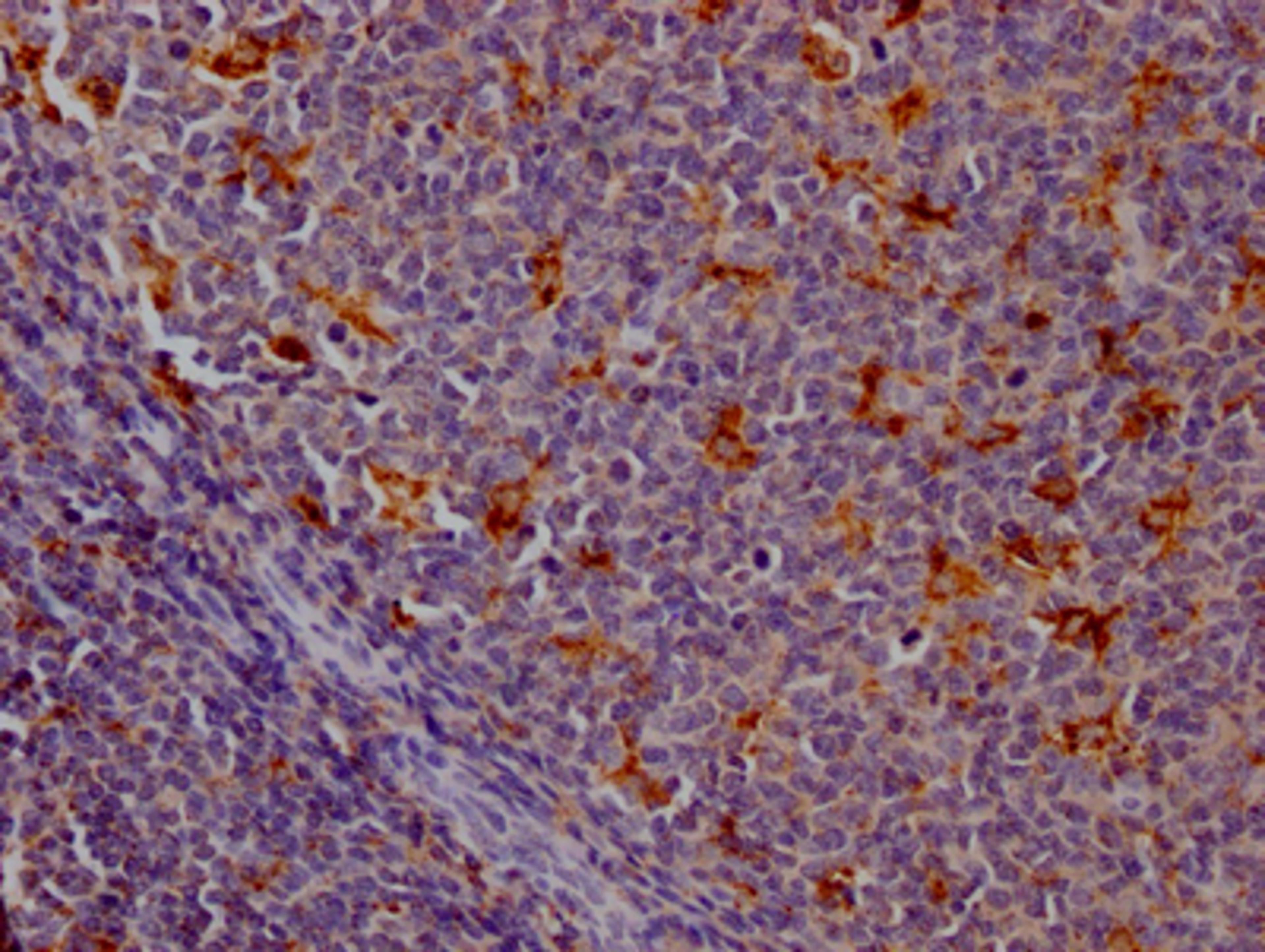 IHC image of CSB-RA788455A0HU diluted at 1:100 and staining in paraffin-embedded human tonsil tissue performed on a Leica BondTM system. After dewaxing and hydration, antigen retrieval was mediated by high pressure in a citrate buffer (pH 6.0). Section was blocked with 10% normal goat serum 30min at RT. Then primary antibody (1% BSA) was incubated at 4℃ overnight. The primary is detected by a Goat anti-rabbit IgG polymer labeled by HRP and visualized using 0.05% DAB.