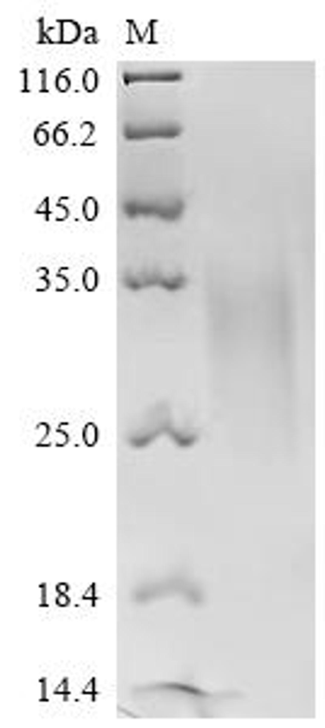(Tris-Glycine gel) Discontinuous SDS-PAGE (reduced) with 5% enrichment gel and 15% separation gel.
