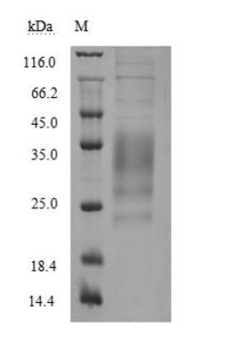 (Tris-Glycine gel) Discontinuous SDS-PAGE (reduced) with 5% enrichment gel and 15% separation gel.